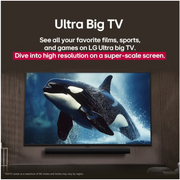 LG 75" UHD 4K Smart TV & 300W Soundbar Ultimate Bundle